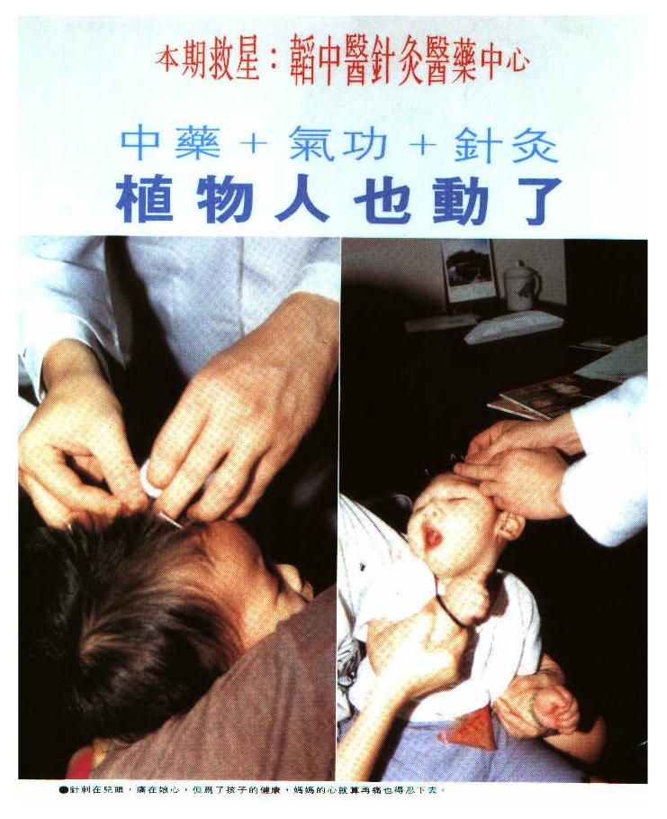 Malaysia Alternative Epilepsy Autism Cure Treatment Acupuncture Herbal Medicine Treatment Centre